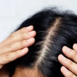 Chute de cheveux chez les femmes de 35 à 40 ans : comprendre et agir