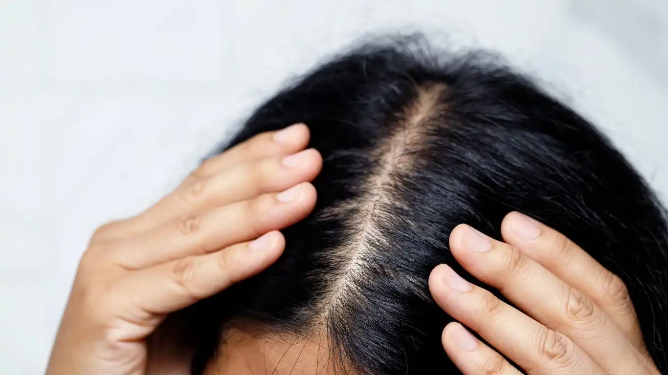 chutte cheveux femme